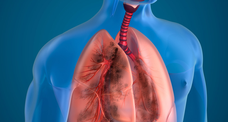 Respiratory Diseases in vashi, navi mumbai - dr chaitanya kulkarni