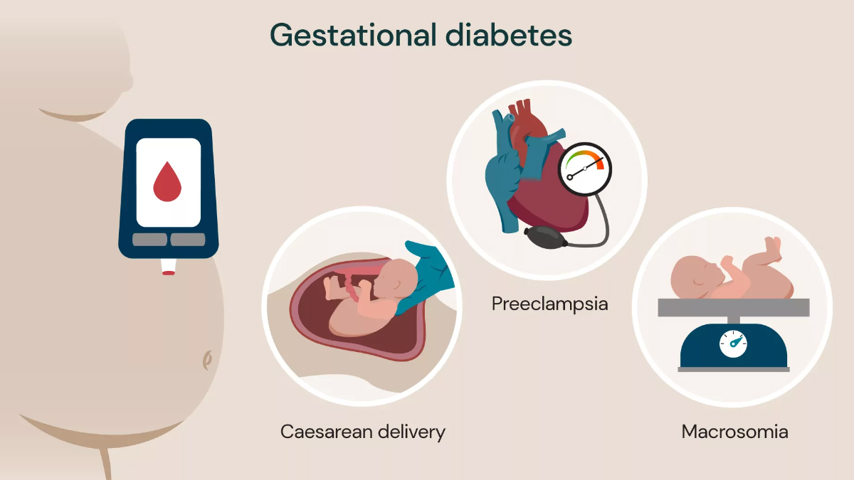 gestational diabetes in vashi, navi mumbai - dr chaitanya kulkarni