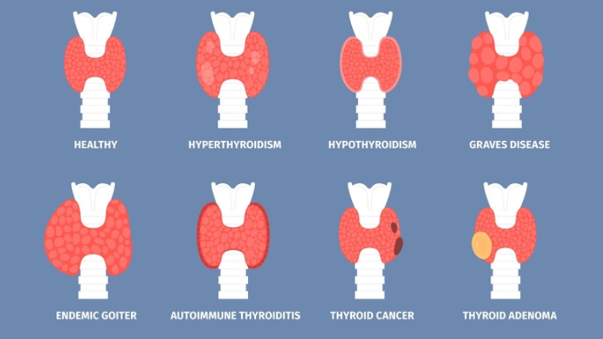 thyroid disorder in vashi, navi mumbai - dr chaitanya kulkarni